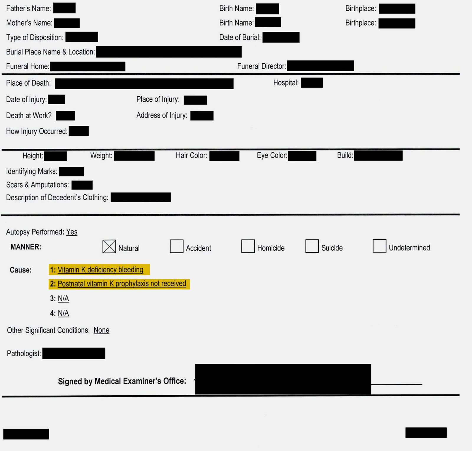 A heavily redacted medical document with personal information, including names, dates and locations, obscured by black bars. Under the “Manner” section, “Natural” is checked. Under “Cause,” two lines are highlighted in yellow: “1: Vitamin K deficiency bleeding” and “2: Postnatal vitamin K prophylaxis not received.”